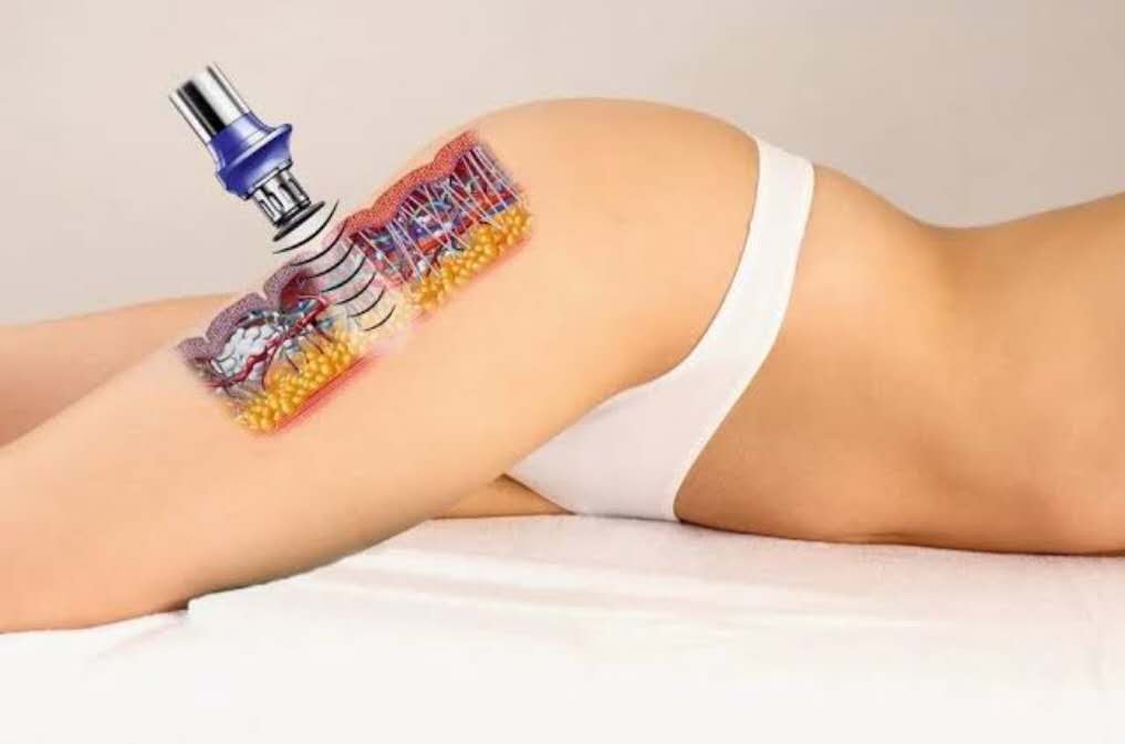 Body Care Laser Acupuncture